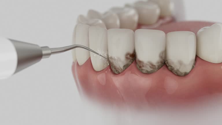 Reliable Dental Implants contractor in Bloomfield, NY by Smile Center Dentistry